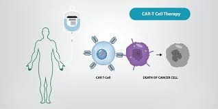 Understanding CAR-T Cell Therapy: Cost, Availability & Success Rate